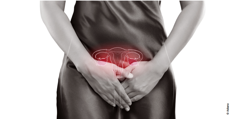 Papillomavirus perte blanche - Analiza Cancer Bucal